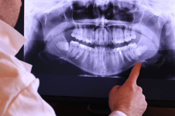 Best Emergency Treatment for Oral Infections in Seville, FL