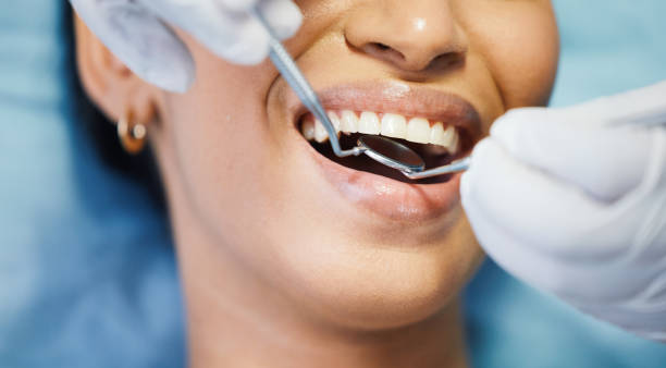 Best Knocked-Out Tooth (Avulsed Tooth) Treatment in Seville, FL